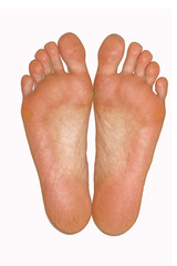 Fototapeta premium broken foot