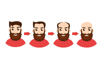 Stages Of Hair Loss with arrow