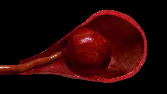 Labor and vaginal birth