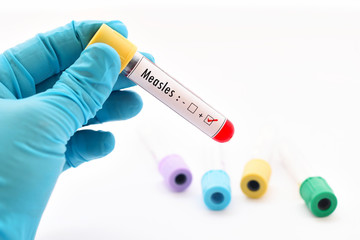 Fototapeta premium Measles virus positive