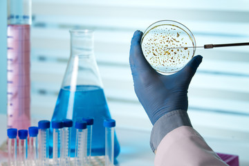 technician holding a petri dish in the biological lab /  taking a sample from a petri dish