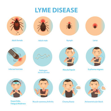 Lyme disease/Patients lyme disease and ticks. vector illustration