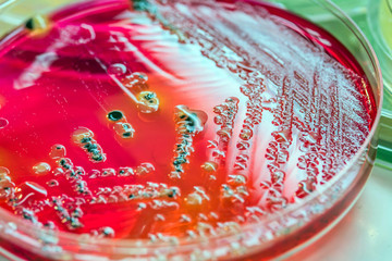 Bacterial colonies culture on  selective agar media(SS agar).