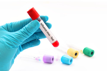 Blood for influenza virus test