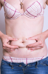 Naklejka premium belly of fat woman