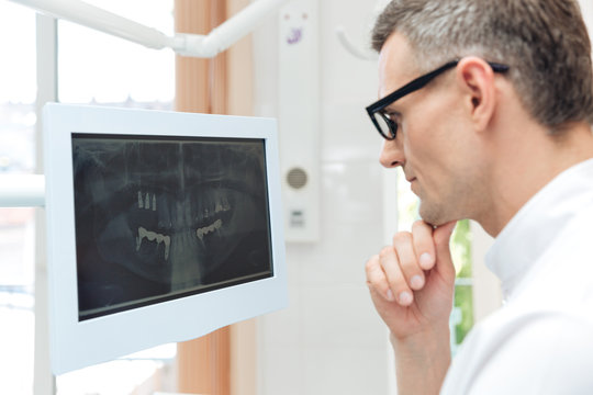 Male dentist looking teeth on digital X-Ray computer monitor