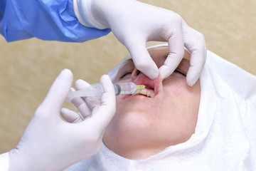 Woman gets anesthetic injection in mouth.