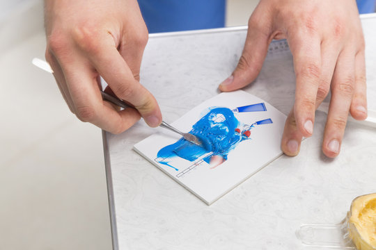 Dentist's Hands Mixing  Blue Silicone Impression Material