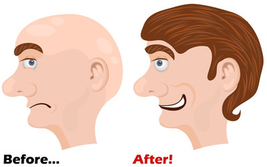 Before and after vector illustration