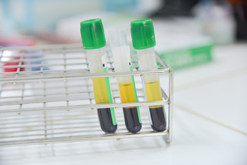 Close up plasma in test tube
