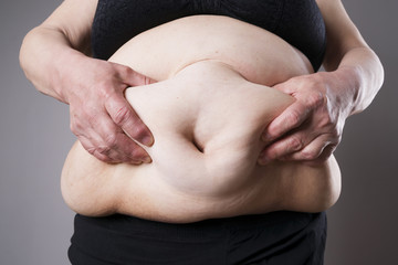 Fat female body. Fatty belly closeup