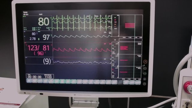 EKG_monitor_Cardiograph