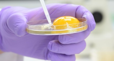 Lebensmittelkontrolle  im Labor Hygiene Ei Salmonellen