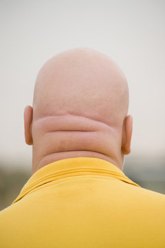 The back of a man's shaved head