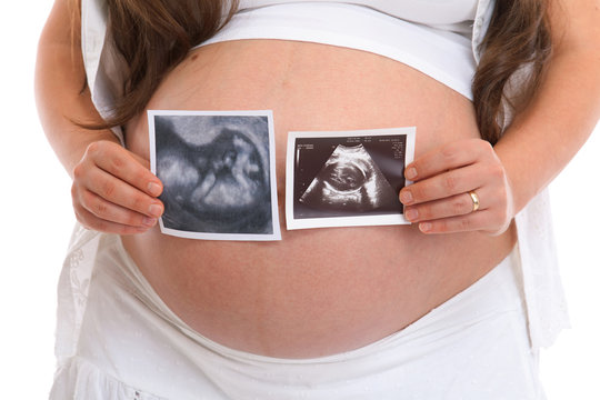 Pregnant woman holding two ultrasound scan photos in front of her belly. Isolated on white background, close up
