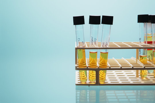 Close up of test tubes in rack against blue background