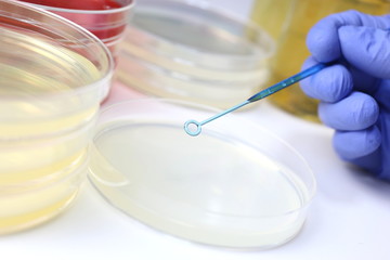 研究イメージ　細菌検査