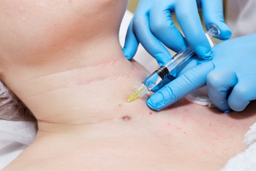 Anti-age injection therapy. Wrinkles reduction.