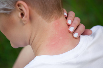 Girl with blond hair, sitting with his back turned and scratchin