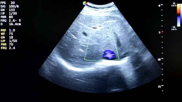 Modern echocardiography (ultrasound) machine monitor. Colour image. New hospitl equipment. Cardiac, Colour M Mode. Pusle..