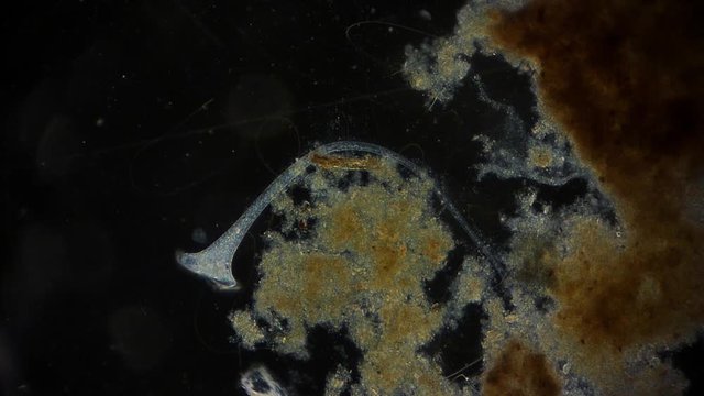Stentor (protozoa) - Protozoen unter dem Mikroskop - Mikrokosmos 1080p FullHD