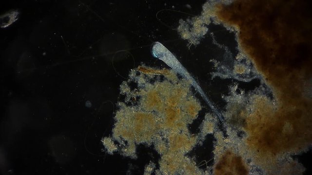 Stentor (protozoa) - Protozoen unter dem Mikroskop - Mikrokosmos 1080p FullHD