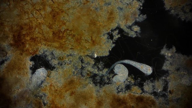 Stentor (protozoa) - Protozoen unter dem Mikroskop - Mikrokosmos 1080p FullHD