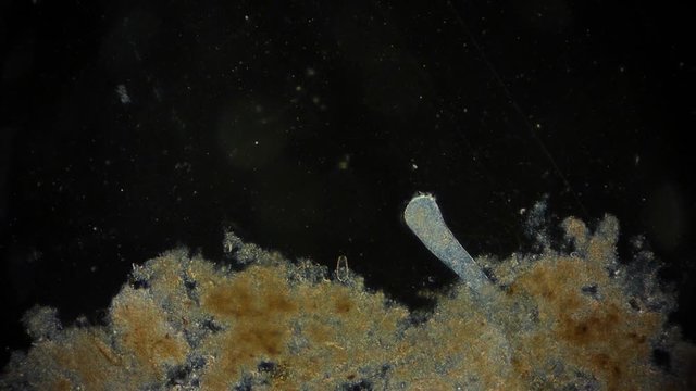 Stentor (protozoa) - Protozoen unter dem Mikroskop - Mikrokosmos 1080p FullHD