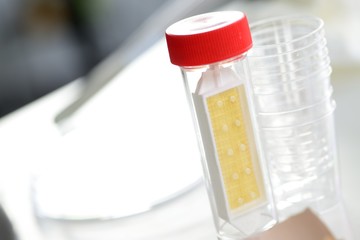 Lebensmittelkontrolle Abklatschtest