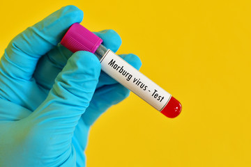 Obraz premium Test tube with blood sample for Marburg virus test 