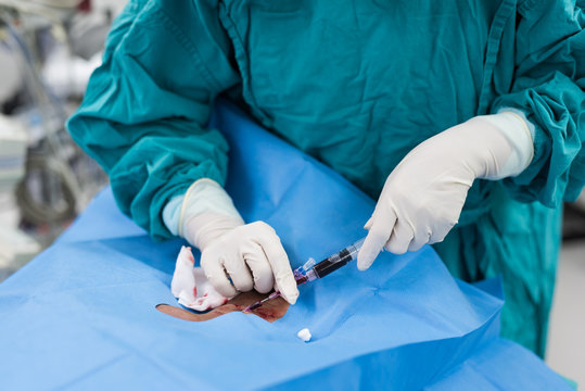 central venous pressure procedure