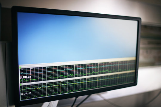 Pulse tracer on wall in hospital