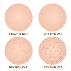 Webstep of healthy skin to dry skin texture , vector