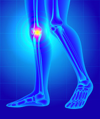 Knee pain. X-ray of the skeleton and legs. Vector illustration created with gradient mesh.