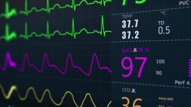 ICU monitor.