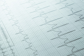 Close up of an electrocardiogram in paper form