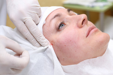 Obraz na płótnie Canvas Procedure of face lifting surgery.