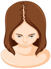 Woman and hair lossing