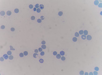 reticulocyte