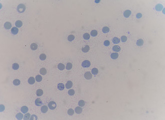 reticulocyte