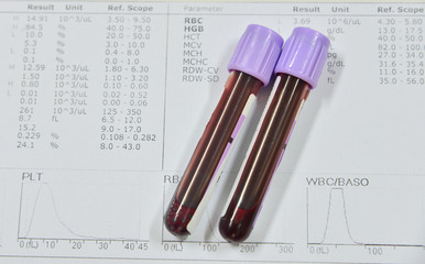  Blood test for Complete Blood Count. CBC