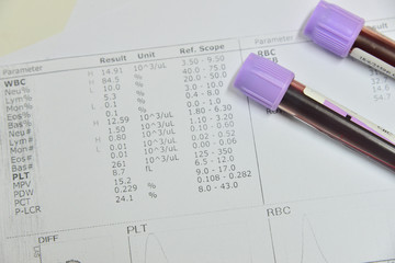  Blood test for Complete Blood Count. CBC
