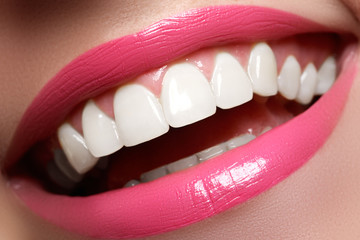 Perfect smile before and after bleaching. Dental care and whitening
