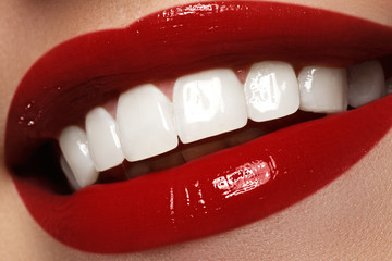Perfect smile after bleaching. Dental care and whitening teeth
