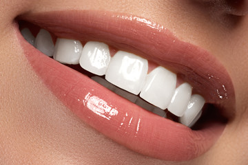 Macro happy woman's smile with healthy white teeth.Lips make-up