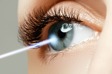 Laser vision correction. Woman's eye. Human eye
