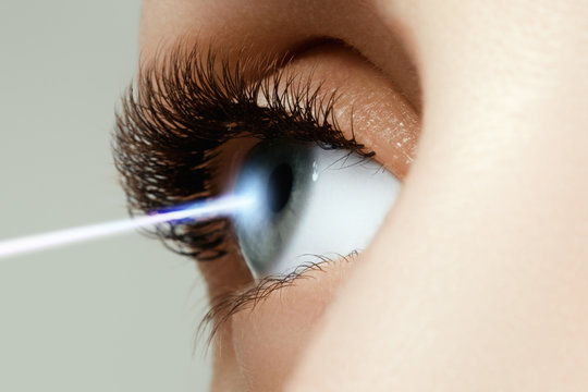 Laser vision correction. Woman's eye. Human eye