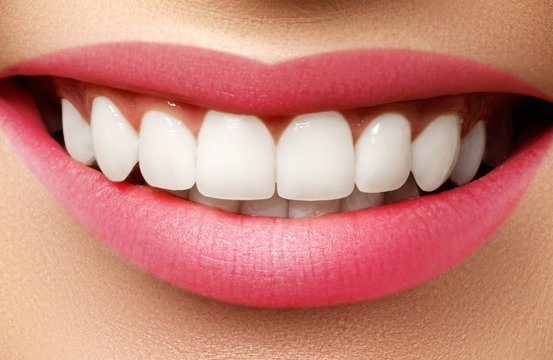 Perfect smile after bleaching. Dental care and whitening teeth