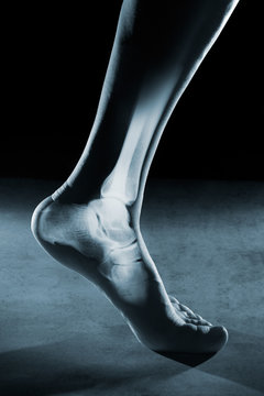 Human foot ankle and leg in x-ray