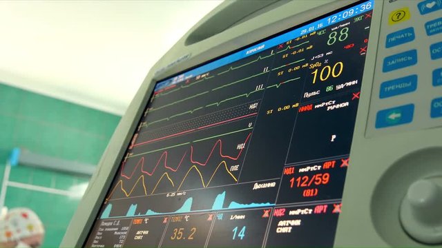 Medical monitor computer with indications of human heart activity